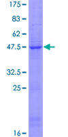 12.5% SDS-PAGE Stained with Coomassie Blue.